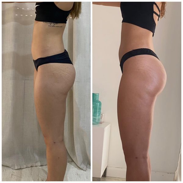 Transformación cliente Teamchorpa